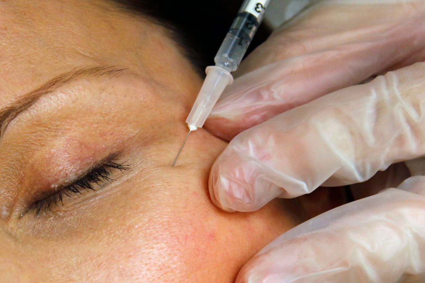 Cosmetic interventions are booming. Many say ethical conversations are lagging | iNFOnews.ca Cosmetic interventions are booming. Many say ethical conversations are lagging | iNFOnews.ca