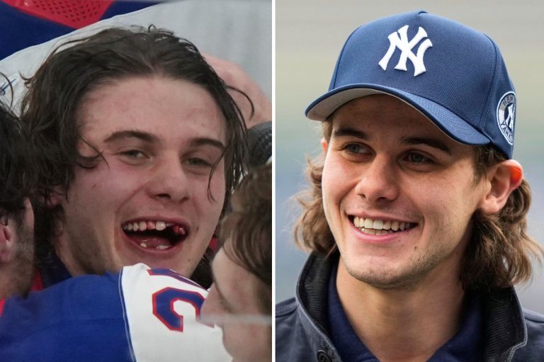 Olympic hero Jack Hughes has new chiclets as NHL dentists get a moment in the spotlight | iNFOnews.ca