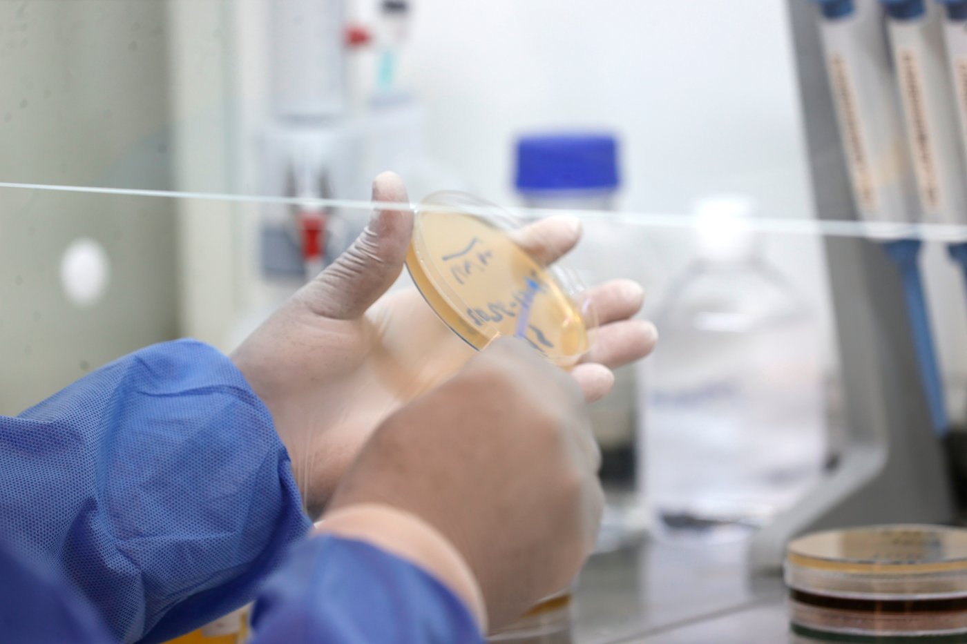West African scientists warn of weakening health systems and urge stronger outbreak detection | iNFOnews.ca