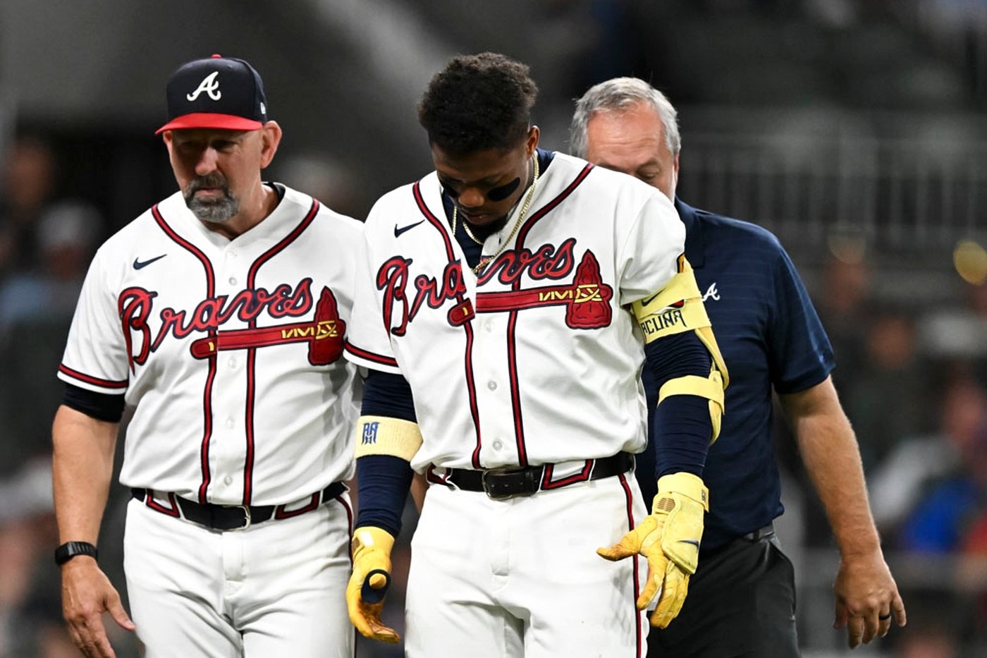 Braves' star Acuña day-to-day after fouling ball off left leg | iNFOnews.ca