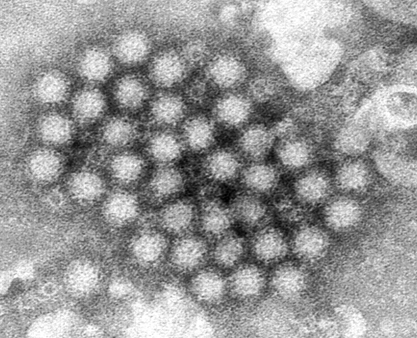 Nasty norovirus is back in full force with US cases of the stomach virus surging | iNFOnews.ca