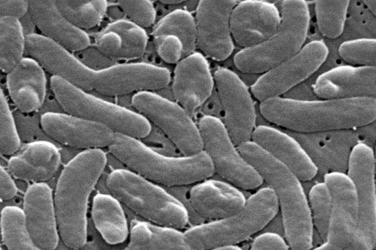Health officials urge caution for Gulf Coast beachgoers during surge of deadly bacterial infections | iNFOnews.ca