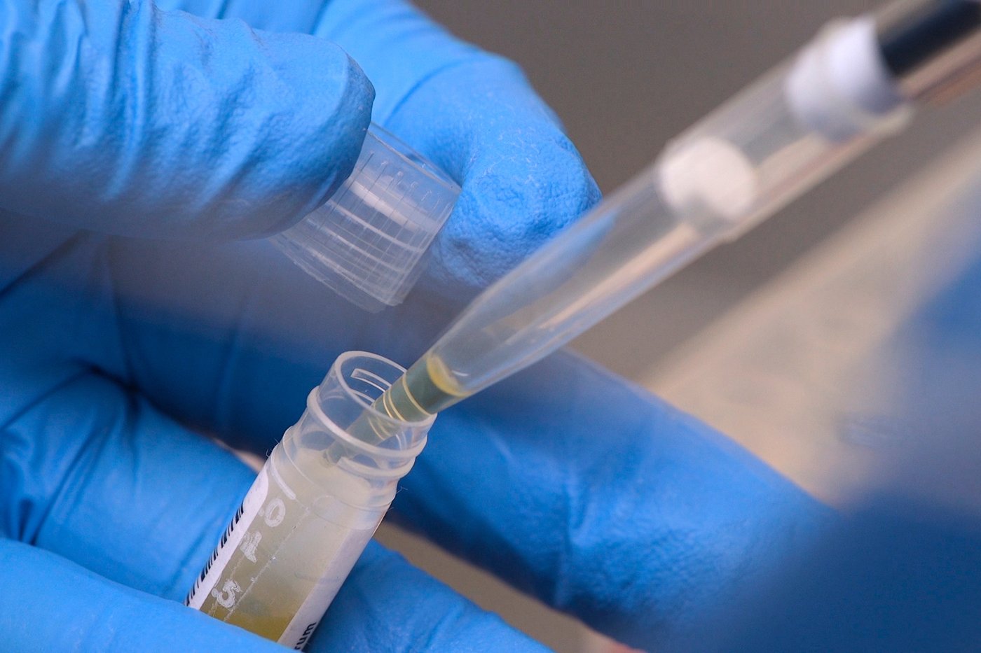 NIH funding cuts have affected over 74,000 people enrolled in experiments, a new report says | iNFOnews.ca NIH funding cuts have affected over 74,000 people enrolled in experiments, a new report says | iNFOnews.ca