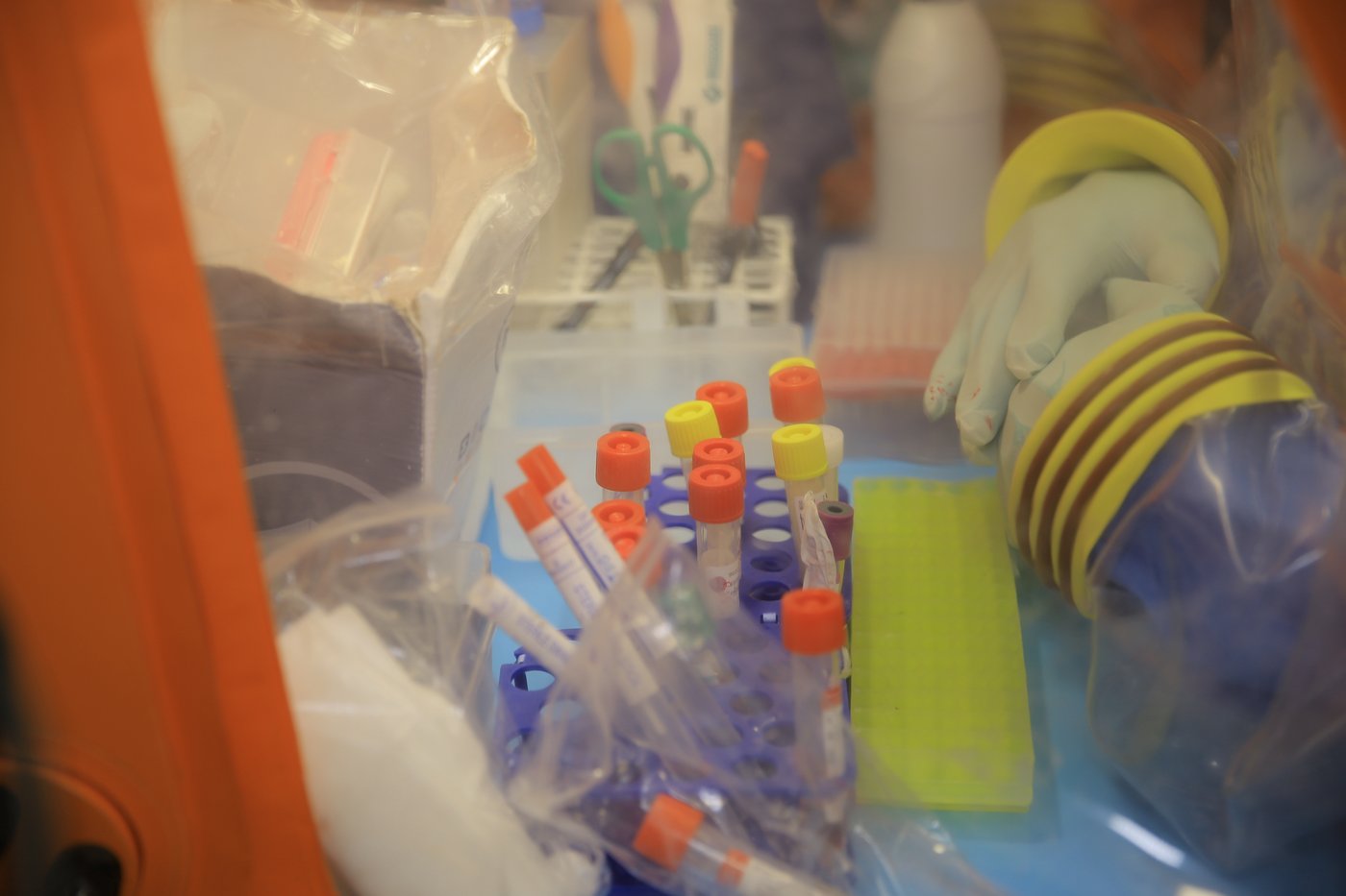 Congo's confirmed Ebola cases exceed 9,000 as containment efforts falter | iNFOnews.ca Congo's confirmed Ebola cases exceed 9,000 as containment efforts falter | iNFOnews.ca