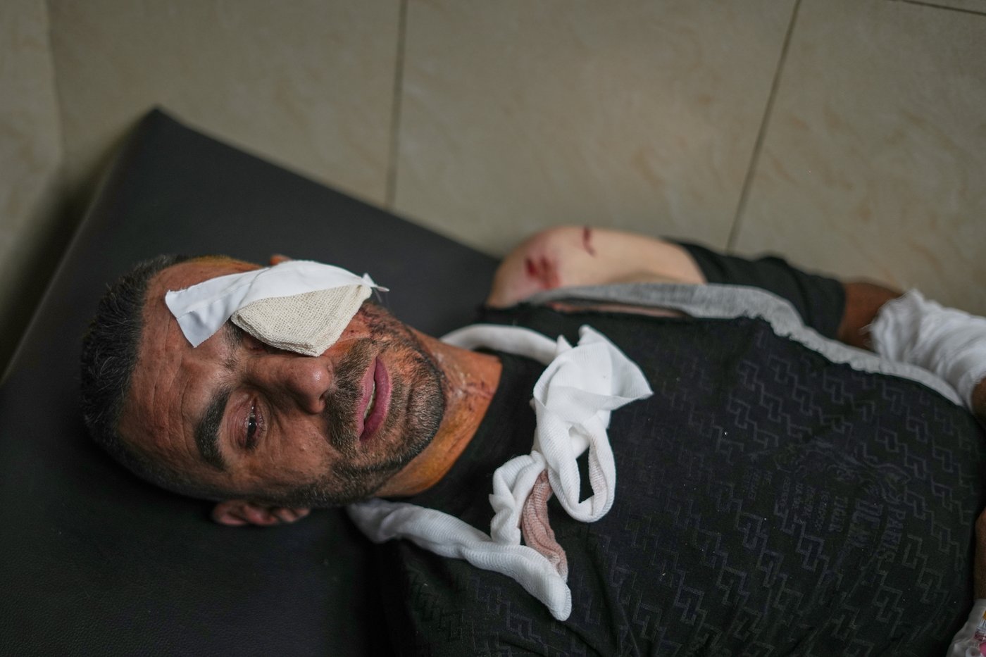 Syria's Health Ministry corrects Damascus minibus blast toll: 14 wounded, no deaths | iNFOnews.ca Syria's Health Ministry corrects Damascus minibus blast toll: 14 wounded, no deaths | iNFOnews.ca