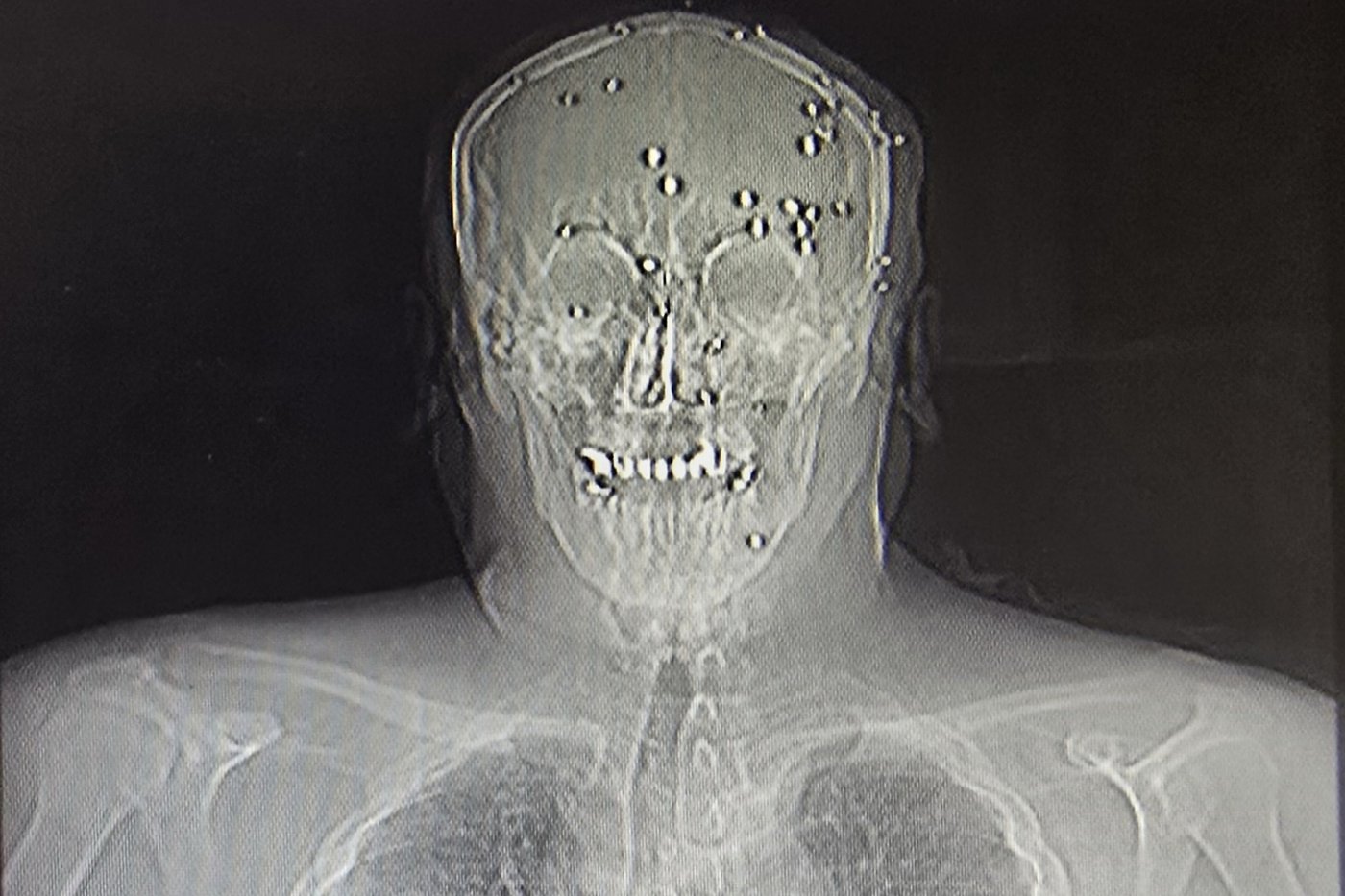 AP reporter speaks to Iranian doctors who say agents intimidated them and obstructed medical care | iNFOnews.ca