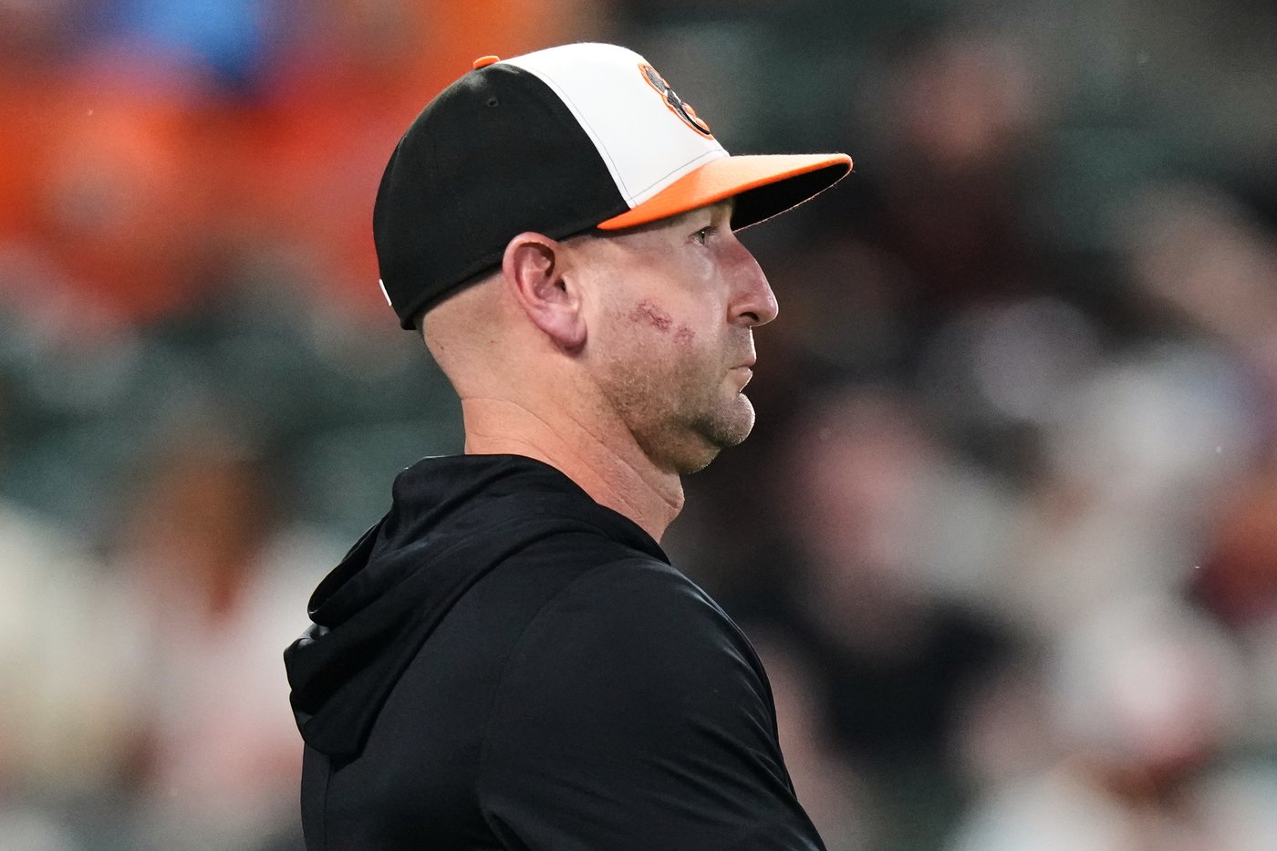 Orioles manager Craig Albernaz returns - with a broken jaw - a day after being hit by a foul ball | iNFOnews.ca Orioles manager Craig Albernaz returns - with a broken jaw - a day after being hit by a foul ball | iNFOnews.ca