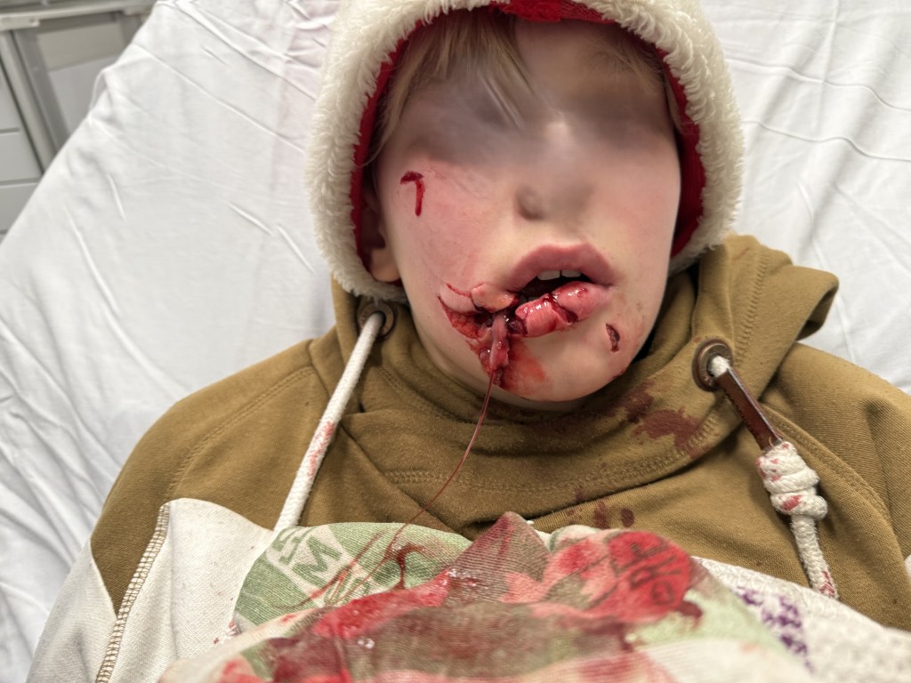 Dog that mauled Kamloops boy returned to owner, mom demands change | iNFOnews.ca Dog that mauled Kamloops boy returned to owner, mom demands change | iNFOnews.ca